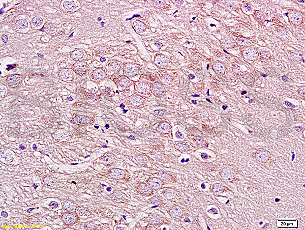 Formalin-fixed and paraffin embedded rat brain labeled with Rabbit Anti GPRIN1 Polyclonal Antibody, Unconjugated (bs-8275R) at 1:200 followed by conjugation to the secondary antibody and DAB staining Formalin-fixed and paraffin embedded rat brain labeled with Rabbit Anti GPRIN1 Polyclonal Antibody, Unconjugated (bs-8275R) at 1:200 followed by conjugation to the secondary antibody and DAB staining