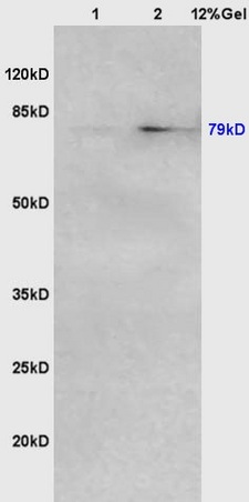 Lane 1: mouse lung lysates Lane 2: mouse intestine lysates probed with Anti VG5Q/AGGF1 Polyclonal Antibody, Unconjugated (bs-7509R) at 1:200 in 4˚C. Followed by conjugation to secondary antibody (bs-0295G-HRP) at 1:3000 90min in 37˚C. Predicted band 79kD. Observed band size: 79kD.