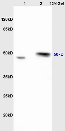 Lane 1: mouse intestine lysates Lane 2: mouse brain lysates probed with Anti Ribonuclease Inhibitor Polyclonal Antibody, Unconjugated (bs-7518R) at 1:200 in 4˚C. Followed by conjugation to secondary antibody (bs-0295G-HRP) at 1:3000 90min in 37˚C. Predicted band 50kD. Observed band size: 50kD.