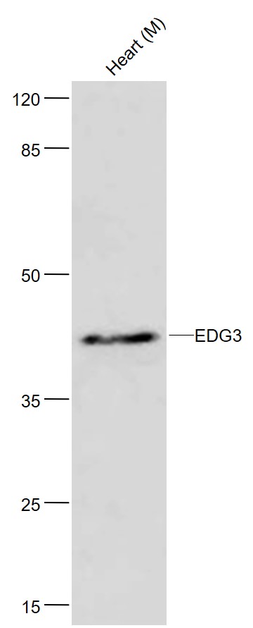 Lane 1: Mouse Heart lysates probed with Anti-EDG3 Polyclonal Antibody, Unconjugated (bs-7541R) at 1:300 in dilution and 4˚C overnight incubation. Followed by conjugated secondary antibody incubation at 1:20000 for 60 min at 37˚C.