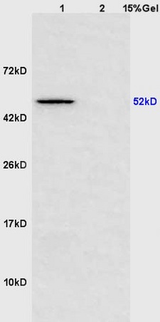 Lane 1: mouse heart lysates Lane 2: mouse brain lysates probed with Anti Scavenger Receptor BII Polyclonal Antibody, Unconjugated (bs-7545R) at 1:200 in 4˚C. Followed by conjugation to secondary antibody (bs-0295G-HRP) at 1:3000 90min in 37˚C. Predicted band 52kD. Observed band size: 52kD.