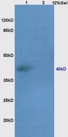 Lane 1: human colon carcinoma lysates Lane 2: mouse thymus lysates probed with Anti SEPT1 Polyclonal Antibody, Unconjugated (bs-7769R) at 1:200 in 4˚C. Followed by conjugation to secondary antibody (bs-0295G-HRP) at 1:3000 90min in 37˚C. Predicted band 40kD. Observed band size: 40kD.