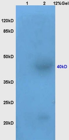 Lane 1: mouse brain lysates Lane 2: mouse kidney lysates probed with Anti AVPR2 Polyclonal Antibody, Unconjugated (bs-10014R) at 1:200 in 4˚C. Followed by conjugation to secondary antibody (bs-0295G-HRP) at 1:3000 90min in 37˚C. Predicted band 40kD. Observed band size: 40kD.