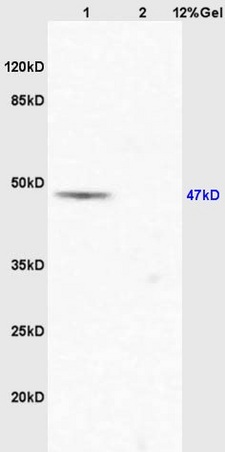 Lane 1: mouse lung lysates Lane 2: mouse stomach lysates probed with Anti EIF5 Polyclonal Antibody, Unconjugated (bs-10035R) at 1:200 in 4˚C. Followed by conjugation to secondary antibody (bs-0295G-HRP) at 1:3000 90min in 37˚C. Predicted band 47kD. Observed band size: 47kD.