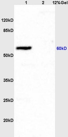 Lane 1: rat brain lysates Lane 2: rat heart lysates probed with Anti CD54\/ICAM-1  Polyclonal Antibody, Unconjugated (bs-0608R) at 1:200 in 4˚C. Followed by conjugation to secondary antibody (bs-0295G-HRP) at 1:3000 90min in 37˚C. Predicted band 60kD. Observed band size: 60kD.