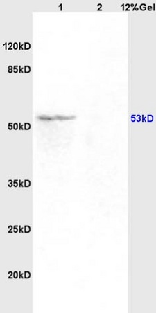 Lane 1: mouse brain lysates Lane 2: rat kidney lysates probed with Anti Acetyl-p53(K382) Polyclonal Antibody, Unconjugated (bs-0905R) at 1:200 in 4˚C. Followed by conjugation to secondary antibody (bs-0295G-HRP) at 1:3000 90min in 37˚C. Predicted band 53kD. Observed band size: 53kD.