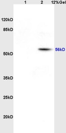 Lane 1: rat heart lysates Lane 2: rat brain lysates probed with Anti EAAT1/Glast Polyclonal Antibody, Unconjugated (bs-1003R) at 1:200 in 4˚C. Followed by conjugation to secondary antibody (bs-0295G-HRP) at 1:3000 90min in 37˚C. Predicted band 56kD. Observed band size: 56kD