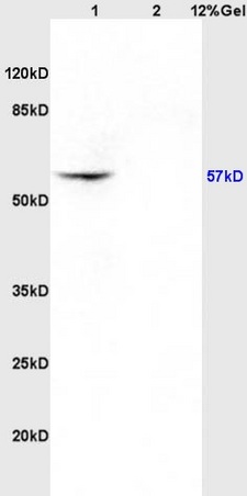 Lane 1: rat brain lysates Lane 2: rat kidney lysates probed with Anti CK4 Polyclonal Antibody, Unconjugated (bs-1006R) at 1:200 in 4˚C. Followed by conjugation to secondary antibody (bs-0295G-HRP) at 1:3000 90min in 37˚C. Predicted band 57kD. Observed band size: 57kD.