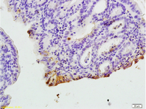 Formalin-fixed and paraffin embedded rat colitis tissue labeled with Anti-CXCR1/IL-8RA Polyclonal Antibody, Unconjugated (bs-1009R) at 1:200, followed by conjugation to the secondary antibody and DAB staining