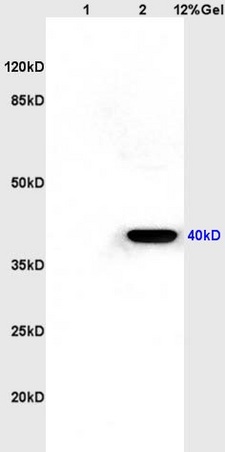 Lane 1: rat kidney lysates Lane 2: rat brain lysates probed with Anti CXCR1/IL-8RA Polyclonal Antibody, Unconjugated (bs-1009R) at 1:200 in 4˚C. Followed by conjugation to secondary antibody (bs-0295G-HRP) at 1:3000 90min in 37˚C. Predicted band 40kD. Observed band size: 40kD.