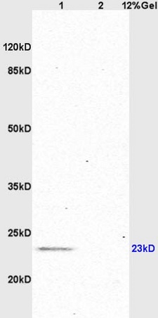 Lane 1: rat brain lysates Lane 2: rat heart lysates probed with Anti GDNF Polyclonal Antibody, Unconjugated (bs-1024R) at 1:200 in 4˚C. Followed by conjugation to secondary antibody (bs-0295G-HRP) at 1:3000 90min in 37˚C. Predicted band 23kD. Observed band size: 23kD.