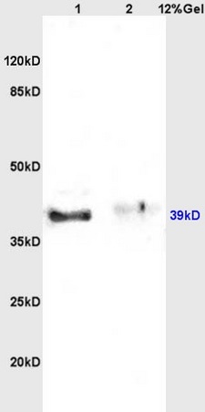 Lane 1: rat brain lysates Lane 2: rat kidney lysates probed with Anti Inhibin Alpha Polyclonal Antibody, Unconjugated (bs-1032R) at 1:200 in 4˚C. Followed by conjugation to secondary antibody (bs-0295G-HRP) at 1:3000 90min in 37˚C. Predicted band 39kD. Observed band size: 39kD