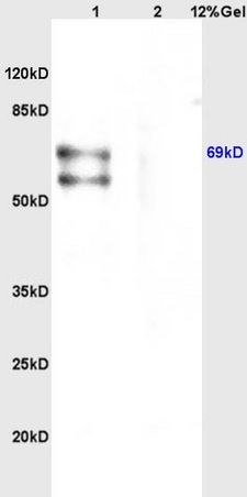 Lane 1: mouse brain lysates Lane 2: mouse heart lysates probed with Anti CHRNA4 Polyclonal Antibody, Unconjugated (bs-1038R) at 1:200 in 4˚C. Followed by conjugation to secondary antibody (bs-0295G-HRP) at 1:3000 90min in 37˚C. Predicted band 69kD. Observed band size: 69kD.