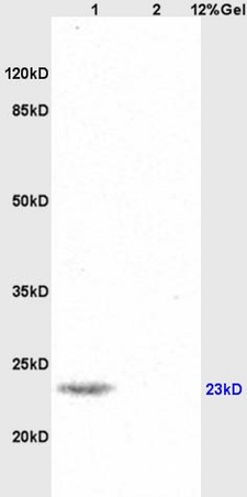 Lane 1: mouse brain lysates Lane 2: human colon carcinoma lysates probed with Anti SNAP25 Polyclonal Antibody, Unconjugated (bs-1131R) at 1:200 in 4˚C. Followed by conjugation to secondary antibody (bs-0295G-HRP) at 1:3000 90min in 37˚C. Predicted band 23kD. Observed band size: 23kD.
