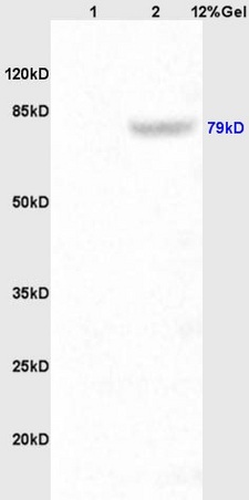 Lane 1: rat kidney lysates Lane 2: mouse intestine lysates probed with Anti P-cadherin Polyclonal Antibody, Unconjugated (bs-1159R) at 1:200 in 4˚C. Followed by conjugation to secondary antibody (bs-0295G-HRP) at 1:3000 90min in 37˚C. Predicted band 79kD. Observed band size: 79kD.