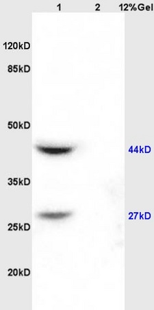 Lane 1: rat kidney lysates Lane 2: rat brain lysates probed with Anti AVPR2 Polyclonal Antibody, Unconjugated (bs-10014R) at 1:200 in 4˚C. Followed by conjugation to secondary antibody (bs-0295G-HRP) at 1:3000 90min in 37˚C. Predicted band 40kD. Observed band size: 40kD