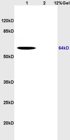 Lane 1: human colon carcinoma lysates Lane 2: rat brain lysates probed with Anti CD166 Polyclonal Antibody, Unconjugated (bs-1251R) at 1:200 in 4˚C. Followed by conjugation to secondary antibody (bs-0295G-HRP) at 1:3000 90min in 37˚C. Predicted band 64kD. Observed band size: 64kD.