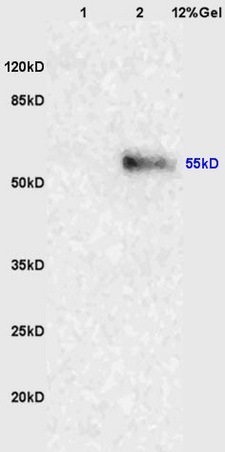 Lane 1: mouse lung lysates Lane 2: human colon carcinoma lysates probed with Anti-NRF-1 Polyclonal Antibody, Unconjugated (bs-1342R) at 1:200 in 4˚C. Followed by conjugation to secondary antibody (bs-0295G-HRP) at 1:3000 90min in 37˚C. Predicted band 55kD. Observed band size: 55kD.
