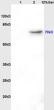 Lane 1: Rat Brain lysates; Lane 2: Rat Kidney lysates; Probed with AFP (A2) Monoclonal Antibody, Unconjugated (bsm-1621M) at 1:200, overnight at 4˚C. Followed secondary antibody (bs-0296G-HRP) at 1:3000 for 90min at 37˚C.