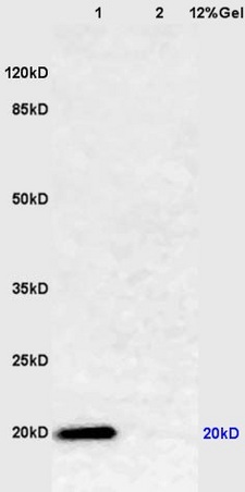 Lane 1: mouse lung lysates Lane 2: mouse muscle lysates probed with Anti Caveolin-1 Polyclonal Antibody, Unconjugated (bs-1453R) at 1:200 in 4˚C. Followed by conjugation to secondary antibody (bs-0295G-HRP) at 1:3000 90min in 37˚C. Predicted band 20kD. Observed band size: 20kD.