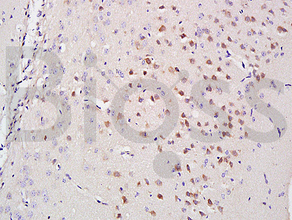 Formalin-fixed and paraffin embedded mouse brain labeled with Anti-A2AR/Adenosine A2a Polyclonal Antibody, Unconjugated (bs-3927R) at 1:200 followed by conjugation to the secondary antibody and DAB staining