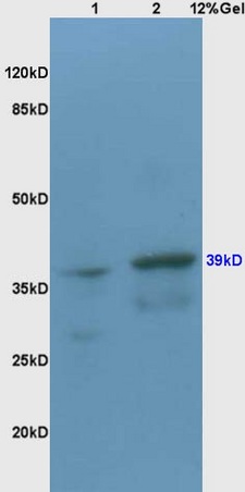 Lane 1: rat brain lysates Lane 2: mouse heart lysates probed with Anti CX3CR1 Polyclonal Antibody, Unconjugated (bs-1728R) at 1:200 in 4˚C. Followed by conjugation to secondary antibody (bs-0295G-HRP) at 1:3000 90min in 37˚C. Predicted band 39kD. Observed band size: 39kD.
