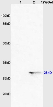 Lane 1: mouse brain lysates Lane 2: human colon carcinoma lysates probed with Anti CDCA5/Sororin Polyclonal Antibody, Unconjugated (bs-7717R) at 1:200 in 4˚C. Followed by conjugation to secondary antibody (bs-0295G-HRP) at 1:3000 90min in 37˚C. Predicted band 28kD. Observed band size: 28kD. Lane 1: mouse brain lysates Lane 2: human colon carcinoma lysates probed with Anti CDCA5/Sororin Polyclonal Antibody, Unconjugated (bs-7717R) at 1:200 in 4˚C. Followed by conjugation to secondary antibody (bs-0295G-HRP) at 1:3000 90min in 37˚C. Predicted band 28kD. Observed band size: 28kD.