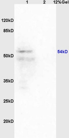 Lane 1: mouse brain lysates Lane 2: mouse heart lysates probed with Anti Iroquois homeobox protein 3 Polyclonal Antibody, Unconjugated (bs-7867R) at 1:200 in 4˚C. Followed by conjugation to secondary antibody (bs-0295G-HRP) at 1:3000 90min in 37˚C. Predicted band 52-55kD. Observed band size: 54kD.