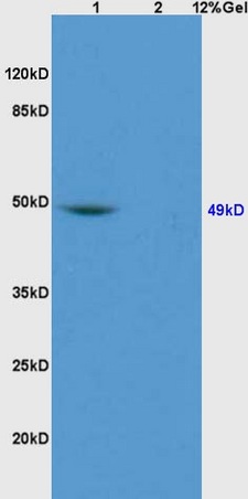 Lane 1: rat brain lysates Lane 2: rat liver lysates probed with Anti GATA4 Polyclonal Antibody, Unconjugated (bs-1778R) at 1:200 in 4˚C. Followed by conjugation to secondary antibody (bs-0295G-HRP) at 1:3000 90min in 37˚C. Predicted band 49kD. Observed band size: 49kD.