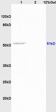 Lane 1: rat brain lysates Lane 2: human colon carcinoma lysates probed with Anti AVPR2 Polyclonal Antibody, Unconjugated (bs-1853R) at 1:200 in 4˚C. Followed by conjugation to secondary antibody (bs-0295G-HRP) at 1:3000 90min in 37˚C. Predicted band 51kD. Observed band size: 51kD.