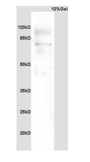 Lane 1: Rat Brain; Probed with PARP1 Polyclonal Antibody, Unconjugated (bs-2138R) at 1:1000 in 4˚C.