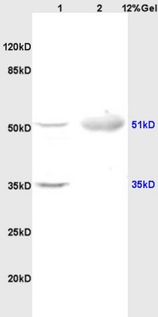 Lane 1: rat brain lysates Lane 2: human colon carcinoma lysates probed with Anti OLFM1/Noelin Polyclonal Antibody, Unconjugated (bs-2173R) at 1:200 in 4˚C. Followed by conjugation to secondary antibody (bs-0295G-HRP) at 1:3000 90min in 37˚C. Predicted band 51kD. Observed band size: 35kD, 51kD.
