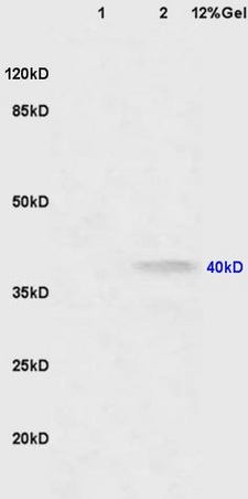 Lane 1: mouse lung lysates Lane 2: mouse brain lysates probed with Anti CNR2/CB2 Polyclonal Antibody, Unconjugated (bs-2377R) at 1:200 in 4˚C. Followed by conjugation to secondary antibody (bs-0295G-HRP) at 1:3000 90min in 37˚C. Predicted band 40kD. Observed band size: 40kD.