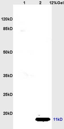 Lane 1: rat kidney lysates Lane 2: rat brain lysates probed with Anti CCL19/MIP-3 beta Polyclonal Antibody, Unconjugated (bs-2454R) at 1:200 in 4˚C. Followed by conjugation to secondary antibody (bs-0295G-HRP) at 1:3000 90min in 37˚C. Predicted band 11kD. Observed band size: 11kD.