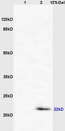 Lane 1: mouse intestine lysates Lane 2: mouse lung lysates probed with Anti CD69/CLEC2C/AIM Polyclonal Antibody, Unconjugated (bs-2499R) at 1:200 in 4˚C. Followed by conjugation to secondary antibody (bs-0295G-HRP) at 1:3000 90min in 37˚C. Predicted band 22kD. Observed band size: 22kD.