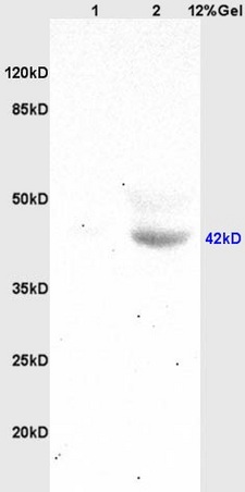 Lane 1: mouse brain lysates Lane 2: human colon carcinoma lysates probed with Anti HOXA10 Polyclonal Antibody, Unconjugated (bs-2502R) at 1:200 in 4˚C. Followed by conjugation to secondary antibody (bs-0295G-HRP) at 1:3000 90min in 37˚C. Predicted band 42kD. Observed band size: 42kD.