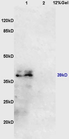 Lane 1: mouse kidney lysates Lane 2: mouse lung lysates probed with Anti AVPR2 Polyclonal Antibody, Unconjugated (bs-2602R) at 1:200 in 4˚C. Followed by conjugation to secondary antibody (bs-0295G-HRP) at 1:3000 90min in 37˚C. Predicted band 39kD. Observed band size: 39kD.