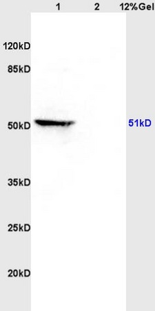 Lane 1: rat brain lysates Lane 2: rat heart lysates probed with Anti MAP3K8/TPL2 Polyclonal Antibody, Unconjugated (bs-3591R) at 1:200 in 4˚C. Followed by conjugation to secondary antibody (bs-0295G-HRP) at 1:3000 90min in 37˚C. Predicted band 51kD. Observed band size: 51kD.