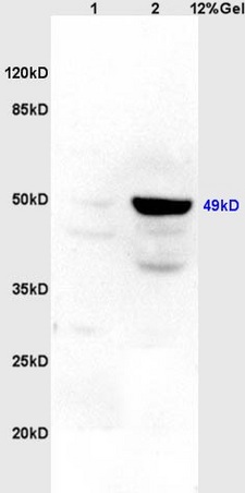 Lane 1: rat brain lysates Lane 2: rat heart lysates probed with Anti Legumain Polyclonal Antibody, Unconjugated (bs-3907R) at 1:200 in 4˚C. Followed by conjugation to secondary antibody (bs-0295G-HRP) at 1:3000 90min in 37˚C. Predicted band 49kD. Observed band size: 49kD. Lane 1: rat brain lysates Lane 2: rat heart lysates probed with Anti Legumain Polyclonal Antibody, Unconjugated (bs-3907R) at 1:200 in 4˚C. Followed by conjugation to secondary antibody (bs-0295G-HRP) at 1:3000 90min in 37˚C. Predicted band 49kD. Observed band size: 49kD.