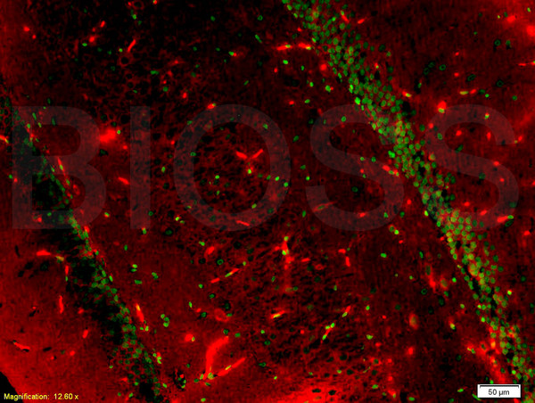 Formalin-fixed and paraffin embedded rat brain tissue labeled with Anti-BrdU(A7) Monoclonal Antibody, FITC Conjugated (bsm-0917M-FITC) at 1:200 for 40 minutes at 37\u00b0C followed by labeling Rabbit Anti-Tubulin Beta, Cy3 conjugated(bs-4511R-Cy3) 1:200, 40 minutes at 37\u00b0C