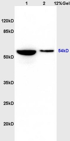 Lane 1: rat heart lysates Lane 2: rat brain lysates probed with Anti phospho-GSK3 Alpha(Ser21) Polyclonal Antibody, Unconjugated (bs-4692R) at 1:200 in 4˚C. Followed by conjugation to secondary antibody (bs-0295G-HRP) at 1:3000 90min in 37˚C. Predicted band 54kD. Observed band size: 54kD.