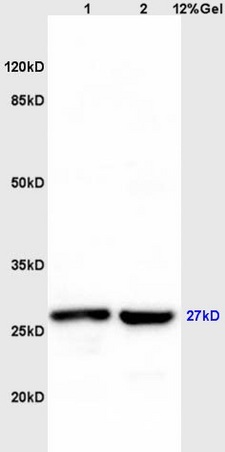 Lane 1: mouse liver lysates Lane 2: mouse brain lysates probed with Anti MS4A2 Polyclonal Antibody, Unconjugated (bs-4870R) at 1:200 in 4˚C. Followed by conjugation to secondary antibody (bs-0295G-HRP) at 1:3000 90min in 37˚C. Predicted band 27kD. Observed band size: 27kD.
