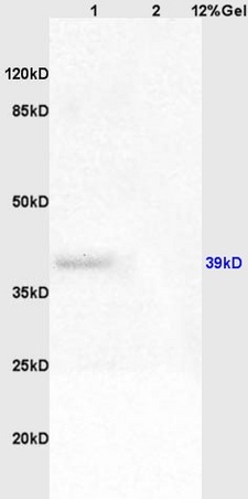 Lane 1: rat brain lysates Lane 2: rat liver lysates probed with Anti Adenovirus 5 E1A Polyclonal Antibody, Unconjugated (bs-6136R) at 1:200 in 4˚C. Followed by conjugation to secondary antibody (bs-0295G-HRP) at 1:3000 90min in 37˚C. Predicted band 32kD. Observed band size: 32kD