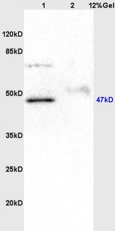 Lane 1: rat brain lysates Lane 2: human colon carcinoma lysates probed with Anti KIST/UHMK1 Polyclonal Antibody, Unconjugated (bs-6260R) at 1:200 in 4˚C. Followed by conjugation to secondary antibody (bs-0295G-HRP) at 1:3000 90min in 37˚C. Predicted band 47kD. Observed band size: 47kD.