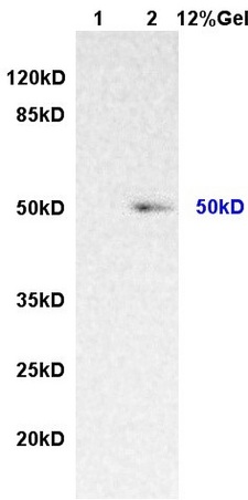 Lane 1: rat lung lysates Lane 2: human colon carcinomalysates probed with AntiIL-7Ra/CD127 Polyclonal Antibody, Unconjugated (bs-1540R) at 1:200 in 4˚C. Followed by conjugation to secondary antibody (bs-0295G-HRP) at 1:3000 90min in 37˚C. Predicted band 50kD. Observed band size: 50kD.\n