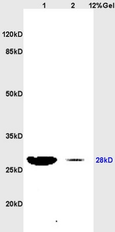 Lane 1: rat heart lysates Lane 2: rat brain lysates probed with Anti PRDX3/peroxiredoxin 3Polyclonal Antibody, Unconjugated (bs-1874R) at 1:200 in 4˚C. Followed by conjugation to secondary antibody (bs-0295G-HRP) at 1:3000 90min in 37˚C. Predicted band 28kD. Observed band size: 28kD.\n