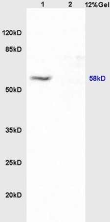 Lane 1: mouse brain carcinoma lysates Lane 2: mouse kidney lysates probed with Anti MITF Polyclonal Antibody, Unconjugated (bs-1990R) at 1:200 in 4˚C. Followed by conjugation to secondary antibody (bs-0295G-HRP) at 1:3000 90min in 37˚C. Predicted band 58kD. Observed band size: 58kD.