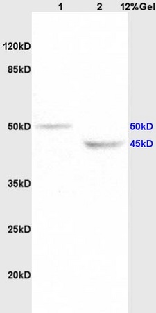 Lane 1: rat brain lysates Lane 2: rat heart lysates probed with Anti KCNN4 Polyclonal Antibody, Unconjugated (bs-6675R) at 1:200 in 4°C. Followed by conjugation to secondary antibody (bs-0295G-HRP) at 1:3000 90min in 37°C. Predicted band 50kD. Observed band size: 45kD, 50kD.