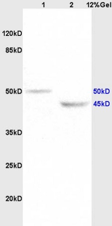 Lane 1: rat brain lysates Lane 2: rat heart lysates probed with Anti KCNN4 Polyclonal Antibody, Unconjugated (bs-6675R) at 1:200 in 4˚C. Followed by conjugation to secondary antibody (bs-0295G-HRP) at 1:3000 90min in 37˚C. Predicted band 50kD. Observed band size: 45kD, 50kD.
