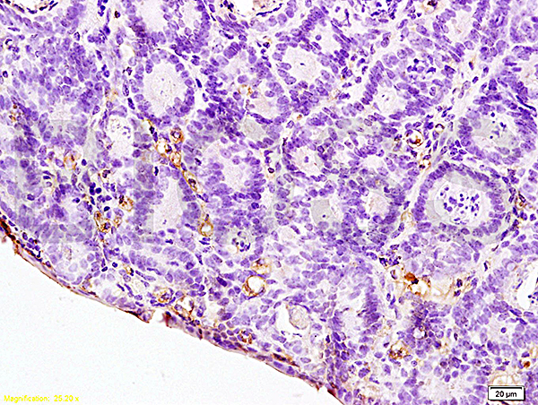 Formalin-fixed and paraffin embedded rat colitis labeled with Anti-IL-12 Polyclonal Antibody, Unconjugated (bs-0767R) at 1:200, followed by conjugation to the secondary antibody and DAB staining